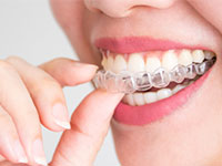 Invisalign Port Hope - Cosmetic Dentistry